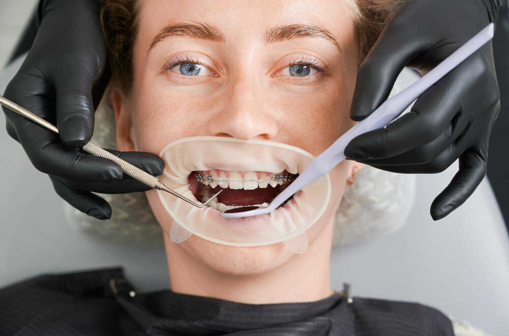 Jak poprawić urodę poprzez leczenie ortodontyczne?